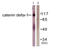 Catenin Delta 1 antibody, abx012812, Abbexa, Western Blot image 