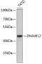 DnaJ Heat Shock Protein Family (Hsp40) Member B12 antibody, 19-470, ProSci, Western Blot image 