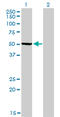 Phosphoglycerate Dehydrogenase antibody, LS-B5457, Lifespan Biosciences, Western Blot image 