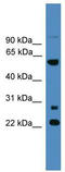 Meiosis Specific Nuclear Structural 1 antibody, TA344866, Origene, Western Blot image 