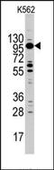 Myosin-Ic antibody, AP13459PU-N, Origene, Western Blot image 