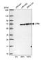 UTP6 Small Subunit Processome Component antibody, NBP1-88468, Novus Biologicals, Western Blot image 