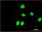 Zinc Finger And SCAN Domain Containing 31 antibody, MA5-22484, Invitrogen Antibodies, Immunofluorescence image 
