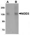 NLR Family CARD Domain Containing 3 antibody, TA320135, Origene, Western Blot image 