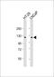 Sterol regulatory element-binding protein cleavage-activating protein antibody, M04507, Boster Biological Technology, Western Blot image 