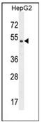 Dipeptidase 3 antibody, AP51310PU-N, Origene, Western Blot image 