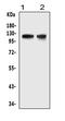 HIF-2-alpha antibody, LS-C343868, Lifespan Biosciences, Western Blot image 