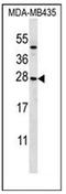 Killer Cell Lectin Like Receptor C1 antibody, AP52396PU-N, Origene, Western Blot image 