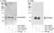 Protein Phosphatase 2 Regulatory Subunit B'Delta antibody, A301-099A, Bethyl Labs, Immunoprecipitation image 