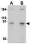 Nucleoporin 107 antibody, GTX31351, GeneTex, Western Blot image 