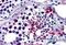 Four And A Half LIM Domains 1 antibody, GTX89663, GeneTex, Immunohistochemistry paraffin image 