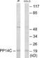 Protein Phosphatase 1 Regulatory Inhibitor Subunit 14C antibody, EKC1877, Boster Biological Technology, Western Blot image 