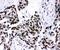 Peroxisome proliferator-activated receptor alpha antibody, PA1412, Boster Biological Technology, Immunohistochemistry frozen image 