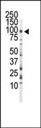 Fibroblast Growth Factor Receptor 3 antibody, AP14342PU-N, Origene, Western Blot image 