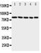 Sp1 Transcription Factor antibody, PA1900, Boster Biological Technology, Western Blot image 