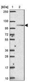 Smoothelin antibody, NBP2-37971, Novus Biologicals, Western Blot image 