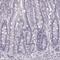 Keratin 74 antibody, NBP2-14645, Novus Biologicals, Immunohistochemistry frozen image 
