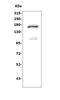 Sorbin And SH3 Domain Containing 1 antibody, A04426-3, Boster Biological Technology, Western Blot image 