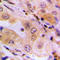 WNK1 antibody, LS-C358398, Lifespan Biosciences, Immunohistochemistry paraffin image 