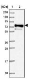 Proline Rich Transmembrane Protein 4 antibody, NBP2-37917, Novus Biologicals, Western Blot image 