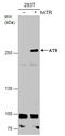 ATR Serine/Threonine Kinase antibody, GTX70109, GeneTex, Western Blot image 