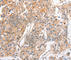 ATP Binding Cassette Subfamily C Member 1 antibody, A3027, ABclonal Technology, Immunohistochemistry paraffin image 