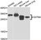 Glutathione S-transferase Mu 4 antibody, abx006651, Abbexa, Western Blot image 