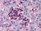 Interferon Regulatory Factor 7 antibody, AP07320PU-N, Origene, Immunohistochemistry paraffin image 