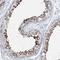 Coiled-Coil Domain Containing 88A antibody, NBP2-38387, Novus Biologicals, Immunohistochemistry paraffin image 