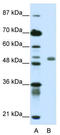 Deformed epidermal autoregulatory factor 1 homolog antibody, TA345315, Origene, Western Blot image 