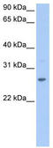 SCP antibody, TA335899, Origene, Western Blot image 