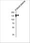 Ceruloplasmin antibody, A02883, Boster Biological Technology, Western Blot image 