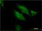 RAB9B, Member RAS Oncogene Family antibody, H00051209-M04, Novus Biologicals, Immunofluorescence image 