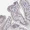 G Protein Nucleolar 2 antibody, HPA027163, Atlas Antibodies, Immunohistochemistry frozen image 
