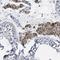 Mov10 Like RISC Complex RNA Helicase 1 antibody, HPA019034, Atlas Antibodies, Immunohistochemistry paraffin image 