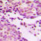 Histone H2B antibody, LS-C356084, Lifespan Biosciences, Immunohistochemistry paraffin image 