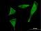 Phosphoribosyl Pyrophosphate Synthetase Associated Protein 2 antibody, H00005636-B01P, Novus Biologicals, Immunofluorescence image 