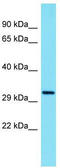 TSR3 Ribosome Maturation Factor antibody, TA334157, Origene, Western Blot image 