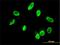 E3 ubiquitin-protein ligase RNF168 antibody, H00165918-M01, Novus Biologicals, Immunocytochemistry image 