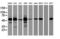 Epoxide Hydrolase 1 antibody, LS-C336966, Lifespan Biosciences, Western Blot image 