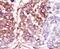 Casein Kinase 1 Gamma 3 antibody, PA5-14301, Invitrogen Antibodies, Immunohistochemistry paraffin image 