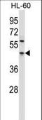 Programmed Cell Death 4 antibody, LS-C163460, Lifespan Biosciences, Western Blot image 