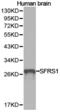 Serine And Arginine Rich Splicing Factor 1 antibody, TA327123, Origene, Western Blot image 