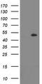Lipoprotein Lipase antibody, TA503810S, Origene, Western Blot image 