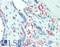 Abhydrolase Domain Containing 12B antibody, LS-C354218, Lifespan Biosciences, Immunohistochemistry paraffin image 
