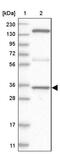 Chromosome 8 Open Reading Frame 48 antibody, PA5-55614, Invitrogen Antibodies, Western Blot image 