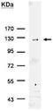 His tag antibody, GTX115045, GeneTex, Immunoprecipitation image 