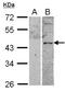 Vasoactive Intestinal Peptide Receptor 2 antibody, NBP2-20867, Novus Biologicals, Western Blot image 