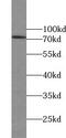 Zinc Finger Protein 443 antibody, FNab09699, FineTest, Western Blot image 