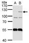 HIF-2-alpha antibody, GTX103707, GeneTex, Western Blot image 